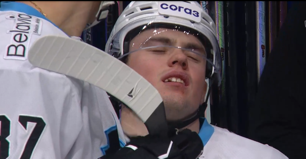 Пышкайло лишился зуба в матче