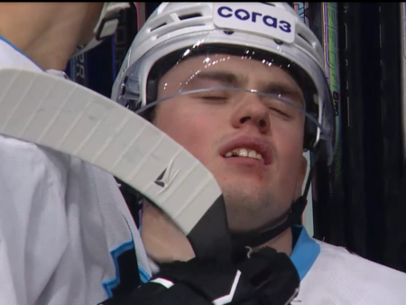 Хоккеист «Динамо» Никита Пышкайло лишился зуба в матче с «Салаватом Юлаевым»